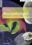 Acta Neuropathologica