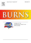 Burns (03054179)
